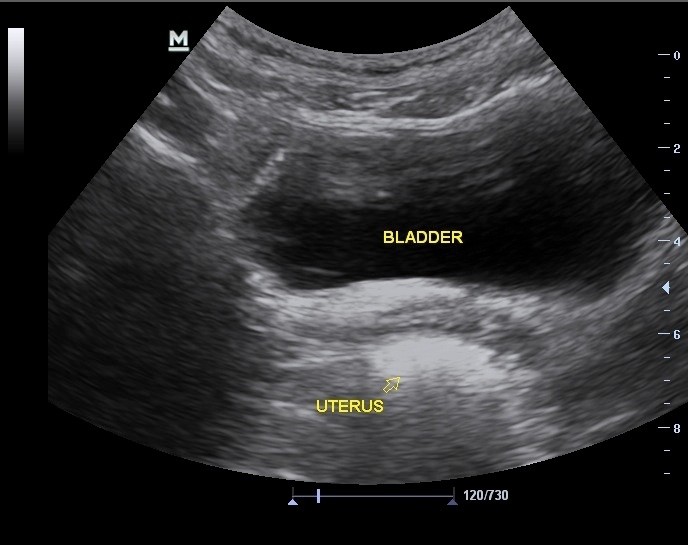 01_Pelvis_Tx_normal_female.jpg