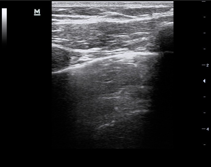 01_ScanPleura.jpg