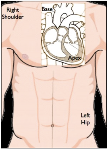 02_AnatCardiacLieCartoon.png